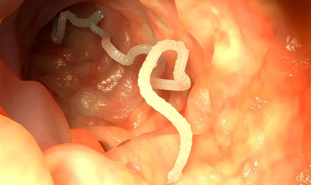 Los gusanos luminales infectan los intestinos. 