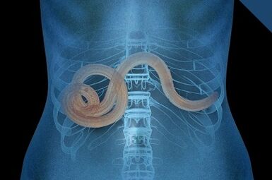 Parásitos en el cuerpo humano
