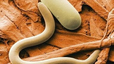parásitos en el cuerpo humano